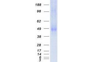 Validation with Western Blot