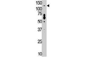 The TLR7 polyclonal antibody  is used in Western blot to detect TLR7 in mouse liver tissue lysate. (TLR7 antibody  (N-Term))