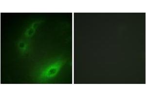 Immunofluorescence analysis of HuvEc cells, using FOXO1A (Ab-329) Antibody. (FOXO1 antibody  (AA 295-344))