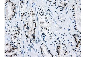 Immunohistochemical staining of paraffin-embedded liver tissue using anti-HNRNPFmouse monoclonal antibody. (HNRNPF antibody)