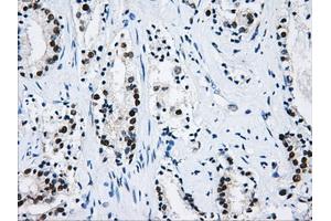 Immunohistochemical staining of paraffin-embedded liver tissue using anti-HNRNPFmouse monoclonal antibody.