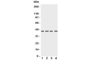 Western blot testing of p53R2 antbody; Lane 1: rat thymus;  2: human MCF-7;  3: (h) A431;  4: (h) HeLa cell lysate. (RRM2B antibody  (C-Term))