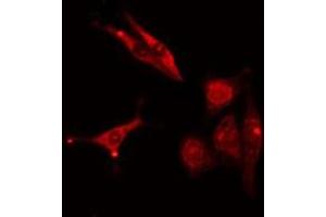 ABIN6277006 staining  COLO205 cells by IF/ICC. (PSMD2 antibody  (C-Term))