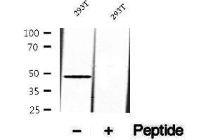 Western blot analysis of extracts of 293T cells, using Phospho-Skp2 (Ser64) Antibody.