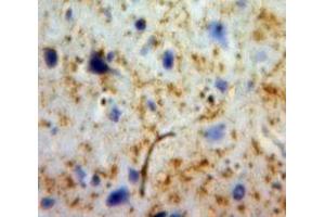 #VALUE! (CDK5 antibody  (AA 92-273))