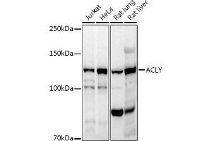 Western blot analysis of extracts of various cell lines, using ACLY antibody (ABIN7265716) at 1:1000 dilution. (ACLY antibody  (AA 752-1101))