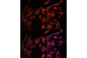 Immunofluorescence analysis of U-2 OS cells using α-Tubulin Rabbit pAb (ABIN3020549, ABIN3020550 and ABIN3020551) at dilution of 1:100 (40x lens).