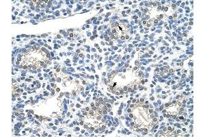ZNF786 antibody was used for immunohistochemistry at a concentration of 4-8 ug/ml to stain Alveolar cells (arrows) in Human Lung. (ZNF786 antibody  (N-Term))