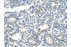 ZNF786 antibody was used for immunohistochemistry at a concentration of 4-8 ug/ml to stain Alveolar cells (arrows) in Human Lung.