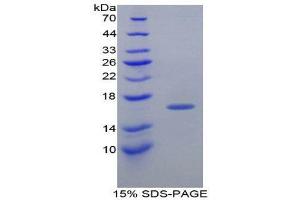 SDS-PAGE (SDS) image for Transthyretin (TTR) (AA 12-126) protein (His tag) (ABIN2127077)