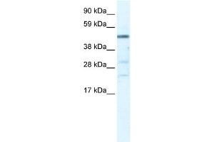 Western Blot showing HSFY1 antibody used at a concentration of 1-2 ug/ml to detect its target protein.
