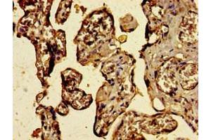 Immunohistochemistry of paraffin-embedded human placenta tissue using ABIN7174832 at dilution of 1:100 (C3ORF14 antibody  (AA 9-128))