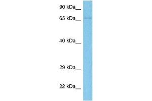 Host:  Rabbit  Target Name:  PUS7  Sample Tissue:  Human 786-0 Whole Cell  Antibody Dilution:  1ug/ml (PUS7 antibody  (N-Term))