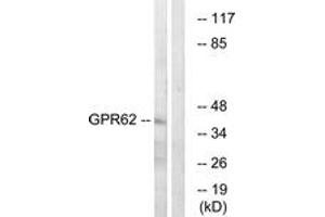 Western blot analysis of extracts from COLO cells, using GPR62 Antibody. (GPR62 antibody  (AA 181-230))