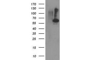Western Blotting (WB) image for anti-Protein Phosphatase, Mg2+/Mn2+ Dependent, 1B (PPM1B) antibody (ABIN1500373) (PPM1B antibody)