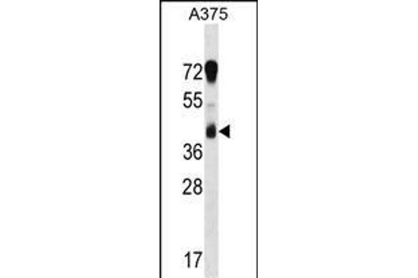 RCN1 Antikörper  (C-Term)