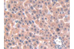 Used in DAB staining on fromalin fixed paraffin- embedded liver tissue (LGALS7 antibody  (AA 1-128))