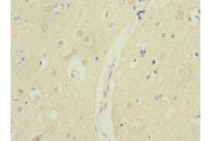 Immunohistochemistry of paraffin-embedded human brain tissue using ABIN7172732 at dilution of 1:100