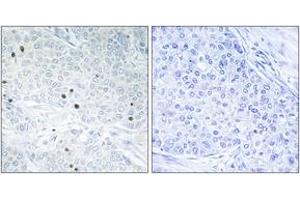 Immunohistochemistry (IHC) image for anti-Tumor Protein P53 Inducible Nuclear Protein 2 (TP53INP2) (AA 1-50) antibody (ABIN2889668) (TP53INP2 antibody  (AA 1-50))