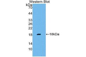 Western Blotting (WB) image for anti-Matrix Metallopeptidase 3 (Stromelysin 1, Progelatinase) (MMP3) (AA 247-370) antibody (ABIN1859855) (MMP3 antibody  (AA 247-370))