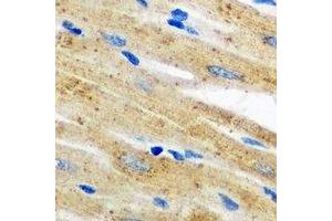 Immunohistochemical analysis of AKR7A2 staining in mouse heart formalin fixed paraffin embedded tissue section. (AKR7A2 antibody)