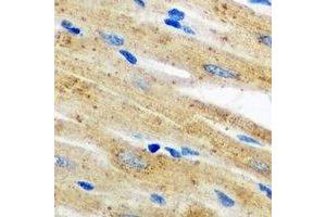 Immunohistochemical analysis of AKR7A2 staining in mouse heart formalin fixed paraffin embedded tissue section.