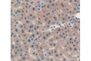 Figure. (beta-2 Microglobulin antibody  (AA 21-119))