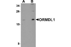 Western blot analysis of ORMDL1 in SK-N-SH Cell lysate with ORMDL1 antibody at (A) 1 µg/mL and (B) 2 µg/mL. (ORMDL1 antibody)