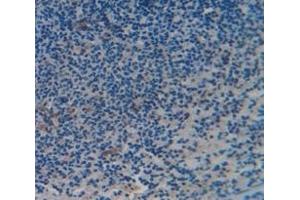 #VALUE! (CD6 antibody  (AA 477-644))