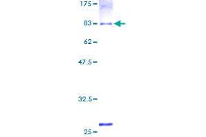 ALDH1B1 Protein (AA 1-517) (GST tag)