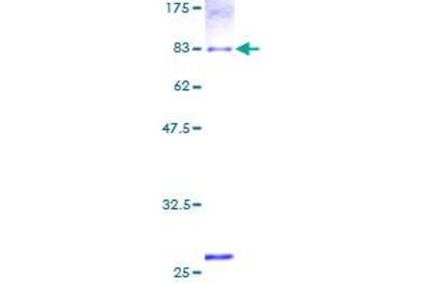 ALDH1B1 Protein (AA 1-517) (GST tag)