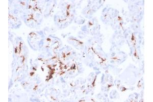 Formalin-fixed, paraffin-embedded human placenta stained with Factor 13A Recombinant Rabbit Monoclonal Antibody (F13A1/3772R). (Recombinant F13A1 antibody  (AA 46-181))