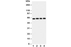 Western blot testing of p62 antibody and Lane 1:  rat brain;  2: HeLa;  3: U87;  4: A549 cell lysate