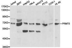 Western Blotting (WB) image for anti-Protein Arginine Methyltransferase 5 (PRMT5) antibody (ABIN1874327) (PRMT5 antibody)