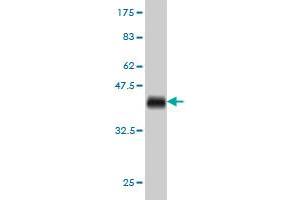 Western Blot detection against Immunogen (36. (DOCK4 antibody  (AA 1867-1966))