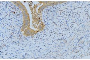 ABIN6268688 at 1/100 staining Human uterus tissue by IHC-P. (IL-4 antibody  (Internal Region))