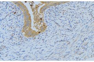 ABIN6268688 at 1/100 staining Human uterus tissue by IHC-P. (IL-4 antibody  (Internal Region))