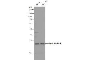 WB Image Endothelin 1 antibody detects Endothelin 1 protein by western blot analysis. (Endothelin 1 antibody  (C-Term))