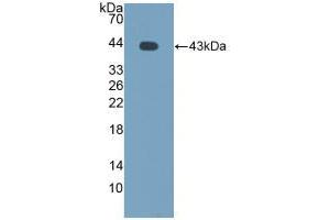 Western blot analysis of recombinant Cow MCP2. (CCL8 antibody  (AA 1-99))