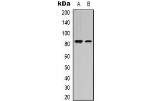 Western blot analysis of STAT4 expression in Hela (A), HEK293T (B) whole cell lysates. (STAT4 antibody  (C-Term))