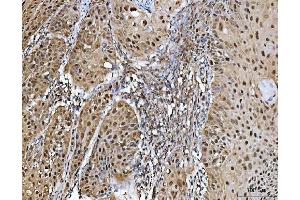 IHC analysis of PRMT5 using anti-PRMT5 antibody (ABIN7600176).