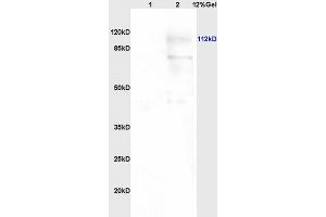 Lane 1: human colon carcinoma lysates Lane 2: rat brain lysates probed with Anti PARP (N-Terminus) Polyclonal Antibody, Unconjugated (ABIN677903) at 1:200 in 4 °C. (PARP1 antibody  (AA 201-300))