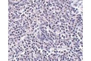 Immunohistochemistry of ARL15 in human spleen tissue with ARL15 antibody at 5 μg/ml. (ARL15 antibody  (Center))