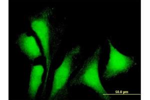 Immunofluorescence of purified MaxPab antibody to G3BP1 on HeLa cell. (G3BP1 antibody  (AA 1-466))