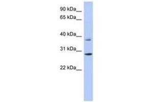 Image no. 1 for anti-Homeobox C5 (HOXC5) (C-Term) antibody (ABIN6742851) (Homeobox C5 antibody  (C-Term))