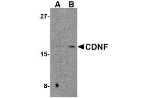 Western blot analysis of CDNF in mouse brain tissue lysate with AP30221PU-N CDNF antibody at (A) 2 and (B) 4 μg/ml.