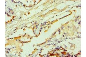 Immunohistochemistry of paraffin-embedded human prostate tissue using ABIN7142626 at dilution of 1:100 (Serotonin Receptor 2B antibody  (AA 382-481))