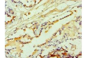 Immunohistochemistry of paraffin-embedded human prostate tissue using ABIN7142626 at dilution of 1:100