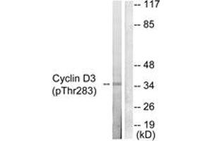 Western blot analysis of extracts from K562 cells treated with UV 5', using Cyclin D3 (Phospho-Thr283) Antibody. (Cyclin D3 antibody  (pSer283))