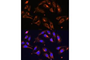 Immunofluorescence analysis of U-2 OS cells using MLPH antibody (ABIN6128273, ABIN6143892, ABIN6143893 and ABIN6222354) at dilution of 1:100. (Melanophilin antibody  (AA 301-600))